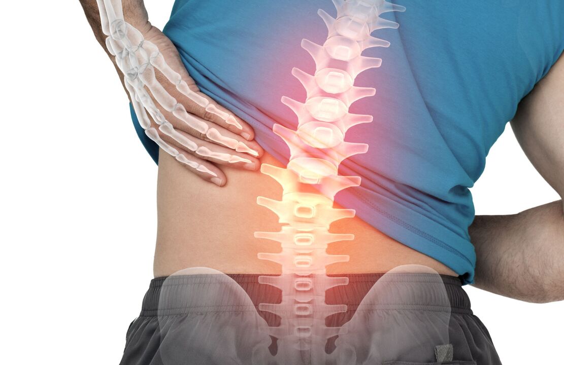 El riesgo de osteondrosis de la columna lumbar