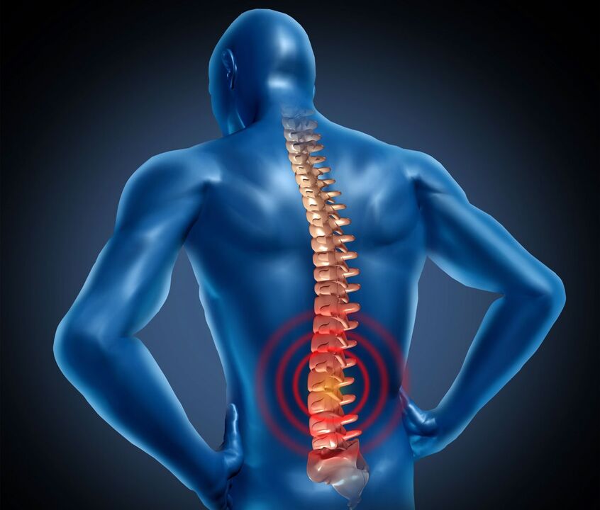 Osteocondrosis de Lumbale