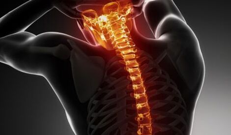 Osteocondrosis de toda la columna