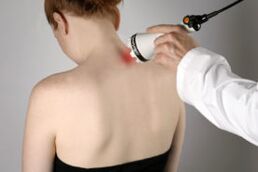 Tratamiento de la osteocondrosis cervical con terapia con láser