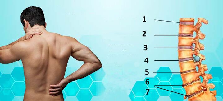 Etapas de desarrollo de la osteocondrosis.